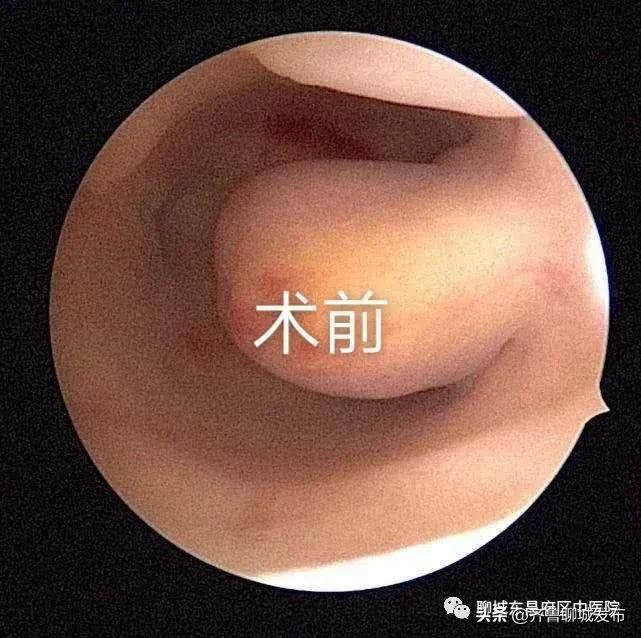 关爱女性健康为妇女健康保驾护航,呵护宫颈