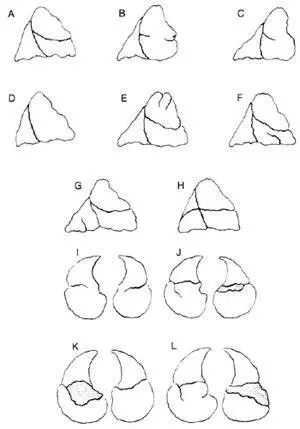 早期肺癌手术半年还是不舒服,早期肺癌手术三年了无化疗