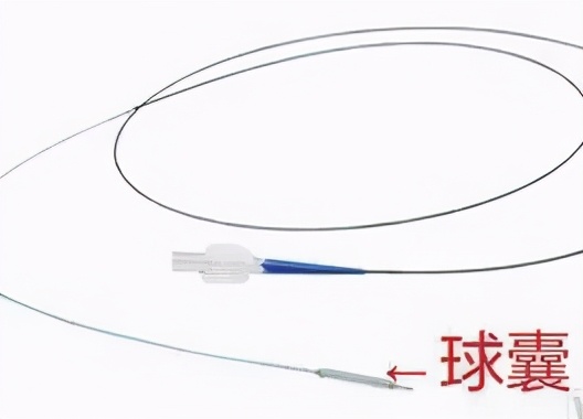 心梗导致心衰可以不做支架,心梗可以不做支架只疏通吗