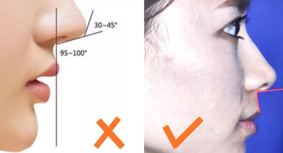 侧面好看和正面好看哪个好,女生侧面怎么才好看