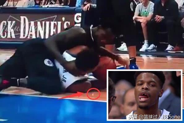 nba球星带上牙套,nba球员牙套在哪放