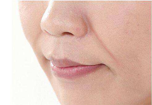 化完妆法令纹明显怎么补救,更年期妇女法令纹明显咋办