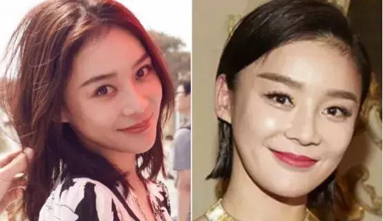 应采儿自曝产后脱发,应采儿产后脱发严重