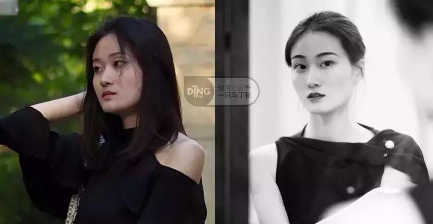 为了变美去整容,整牙堪比整容聊聊我的亲身经历