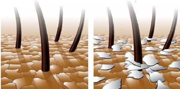 宋慧乔短发上热搜了,2020最火宋慧乔海藻卷