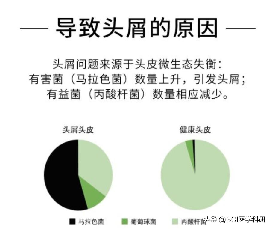 人为什么会长头皮屑简单的回答,头皮屑是什么细胞产生的