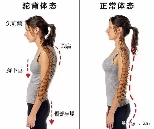含胸驼背肩内扣？5个动作来改善，让你身姿挺拔，体态年轻