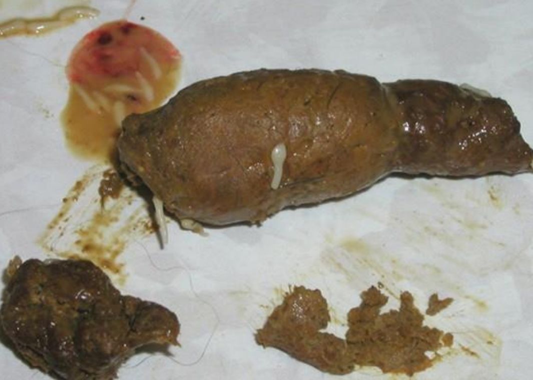 猫咪有绦虫吃什么药,猫咪绦虫是什么样的