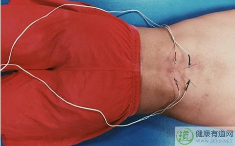 坐医生的床会不会感染病毒,针灸皮肤消毒会阻断病毒吗