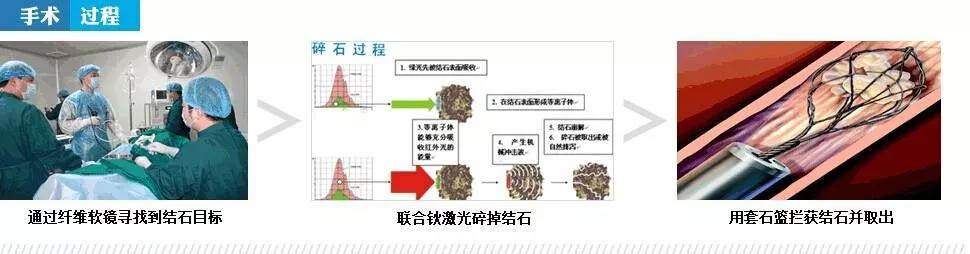泌尿外科是指哪方面,泌尿外科都是些什么病人