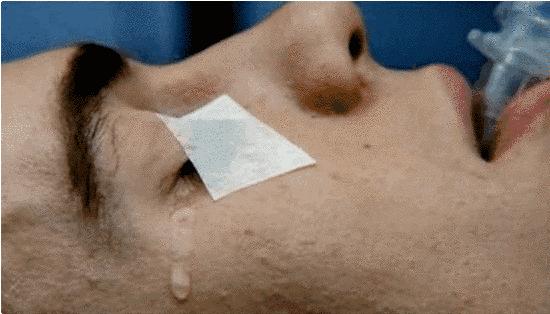 喉咙痛了两天突然之间封喉,感觉喉咙要被封喉