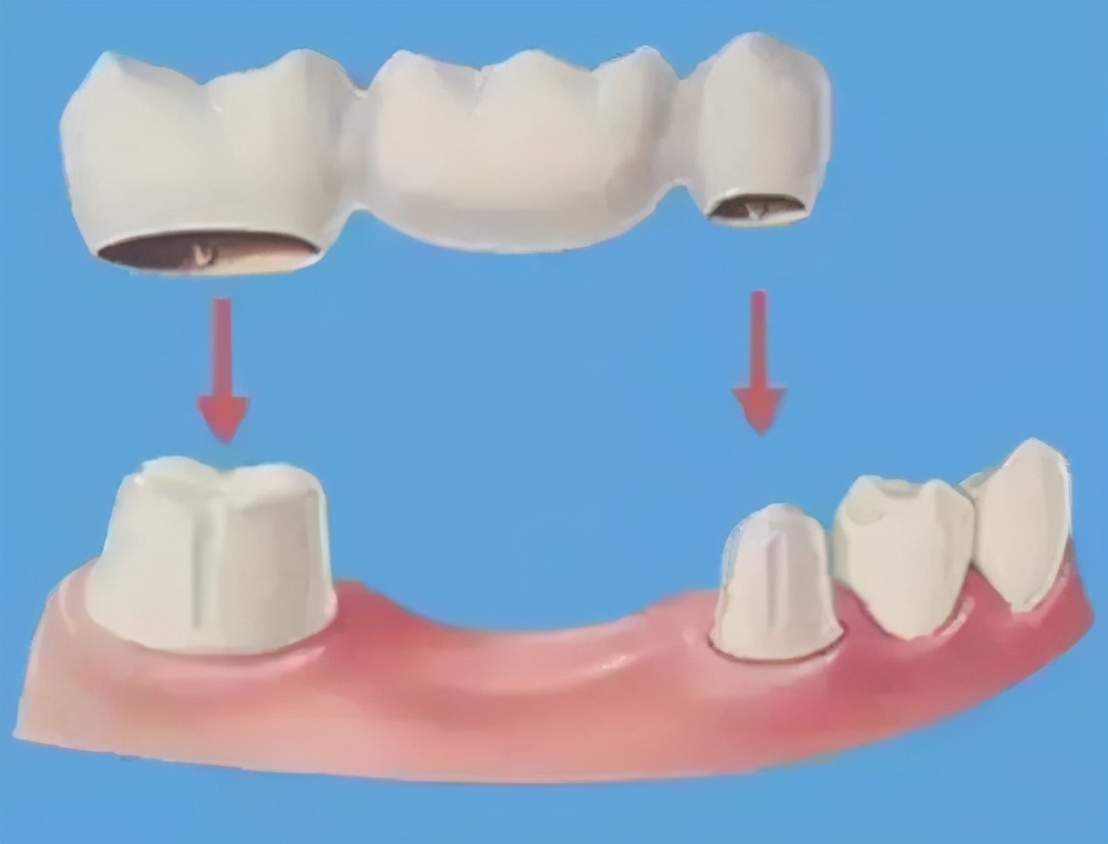 保护牙齿也是一种投资,上海雅悦齿科地址