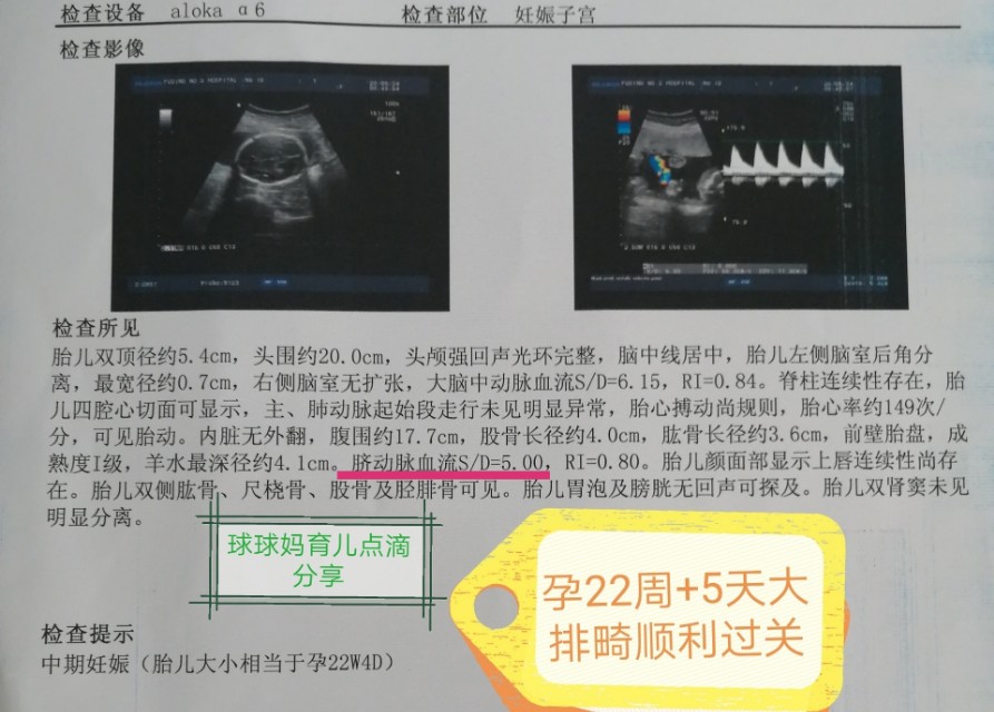 孕期报告单大全,孕期检查报告有哪些