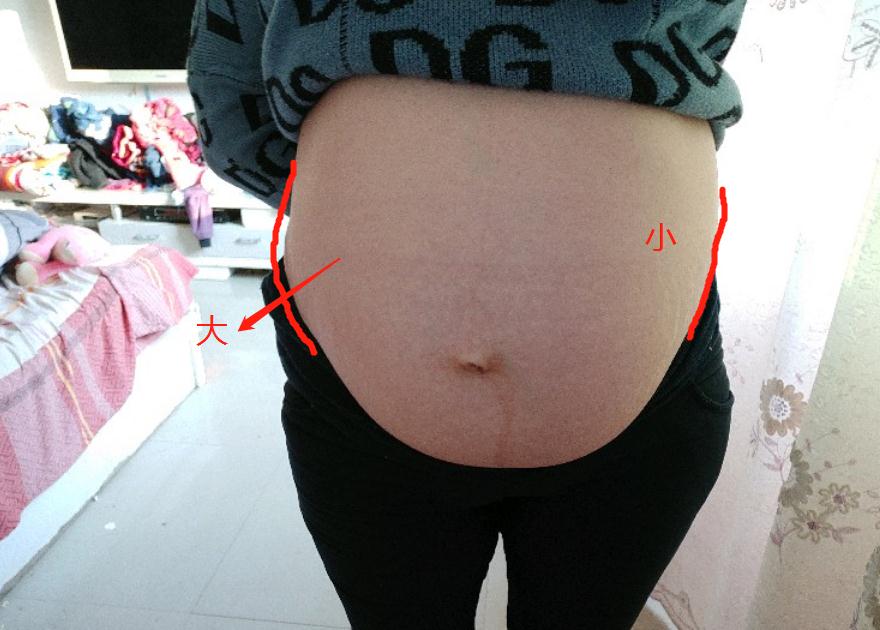 孕妈上怀的肚型和下怀的肚型,孕肚前位和后位的孕肚区别