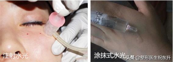 打水光针要问清楚什么,打水光针应该去哪里打好