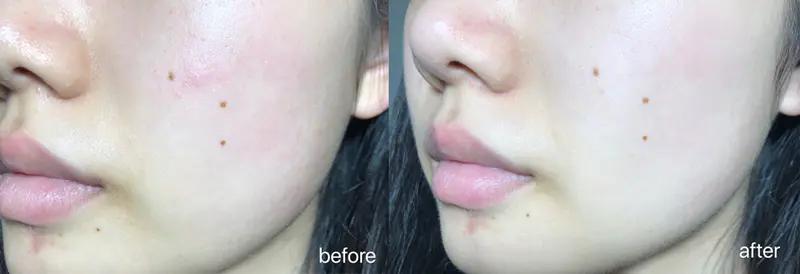 comper美容仪是智商税吗,美容仪哪一个最好用不是智商税