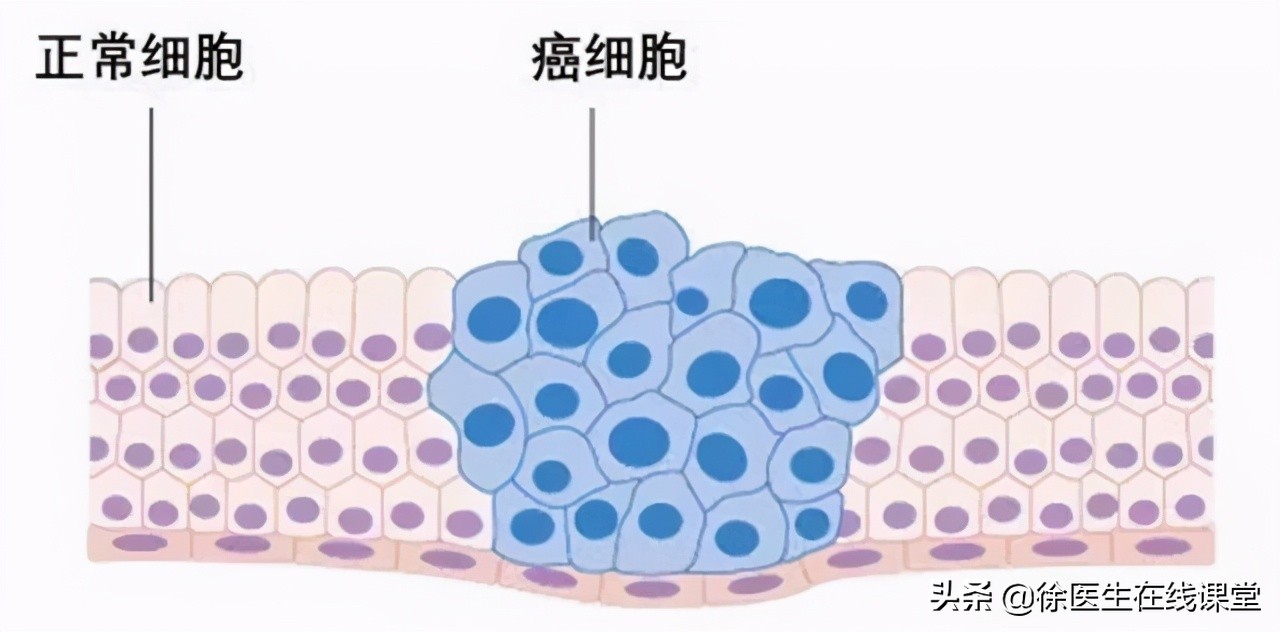 四种血型哪种血型最长寿,a型o型b型ab型哪种血型寿命最长