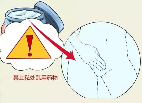 常见的妇科坏习惯,哪些坏习惯导致妇科疾病