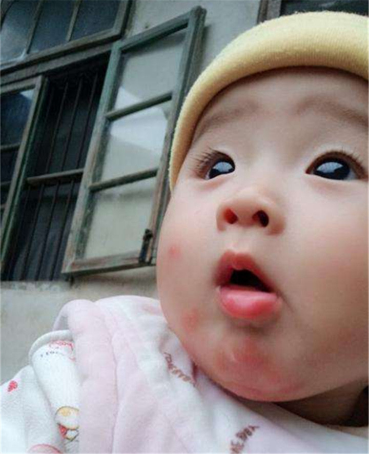 婴儿流口水皮肤发红怎么办,宝宝流口水伤了皮肤