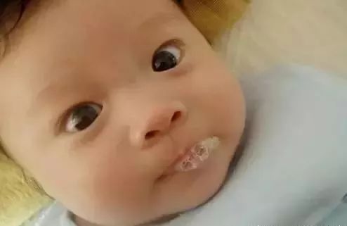 宝宝吐泡泡咳嗽是肺炎吗,如何区分宝宝吐泡泡是否是肺炎