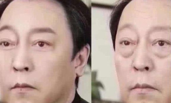 艾灸1小时,迅速提升下垂脸!简简单单就变美!