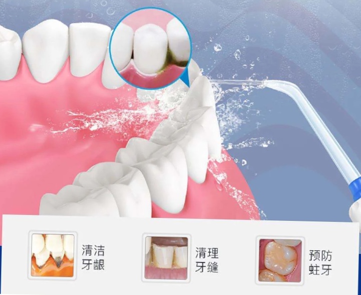 洗牙损伤牙齿别听牙医忽悠,洗牙把黑线洗掉有危害吗