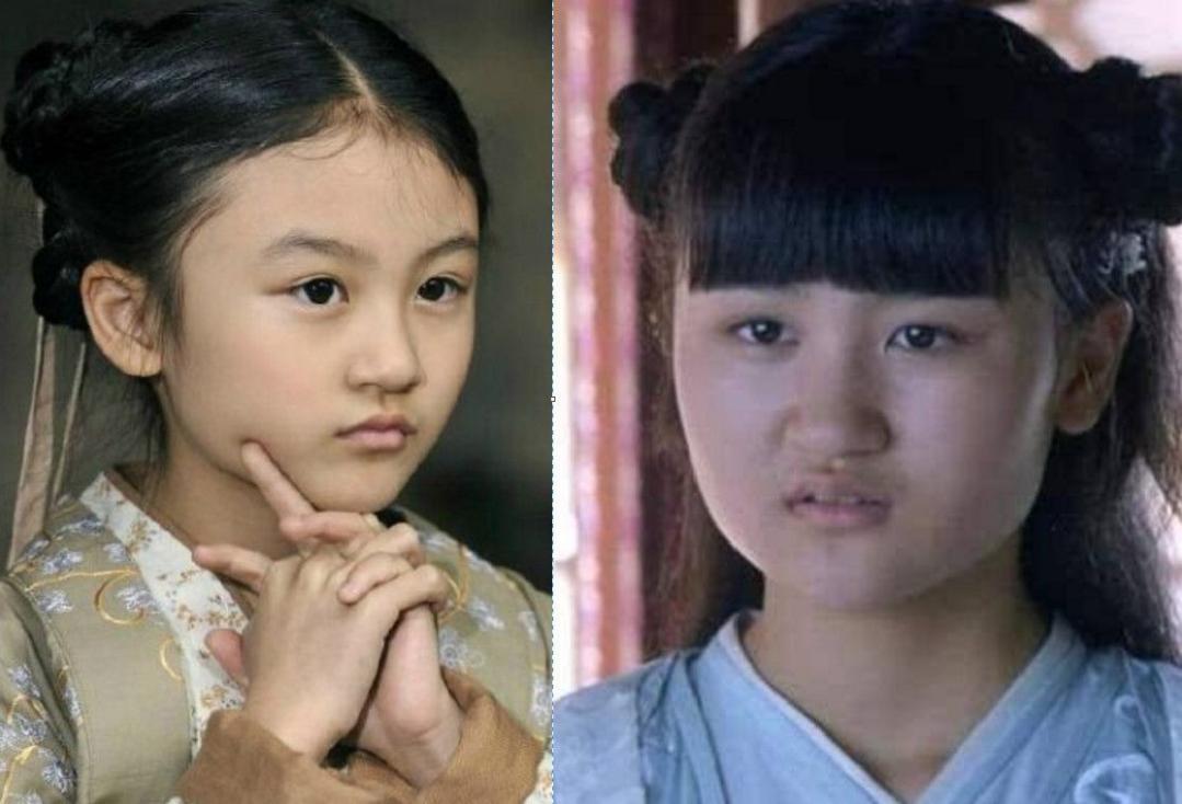 五官好看的脸型特别显老,五官再好看也扛不住秃发