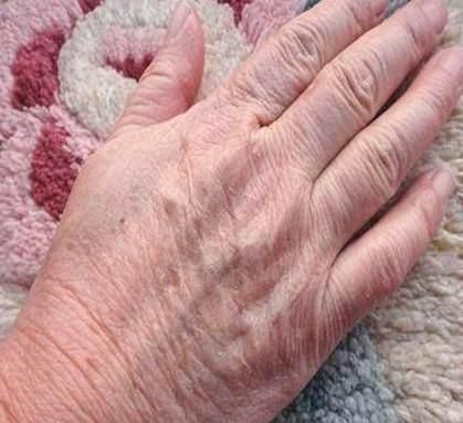 如何将手部快速变得光滑白嫩,双手变白嫩的小妙招