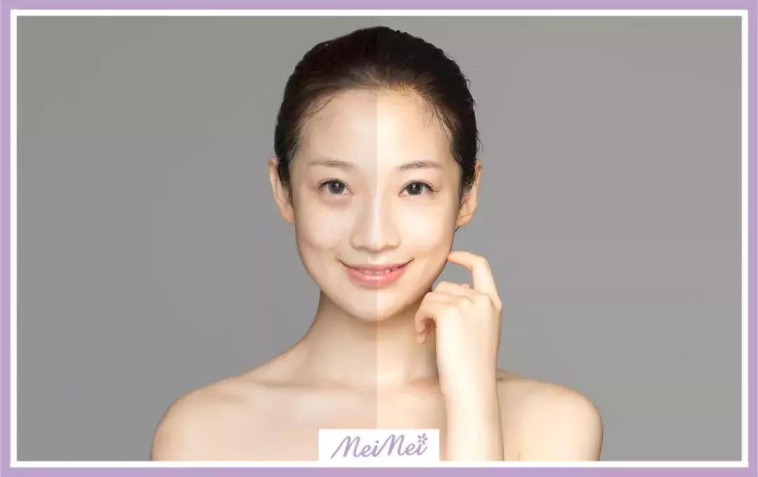 了解美容的方法是什么样的,了解医美问题