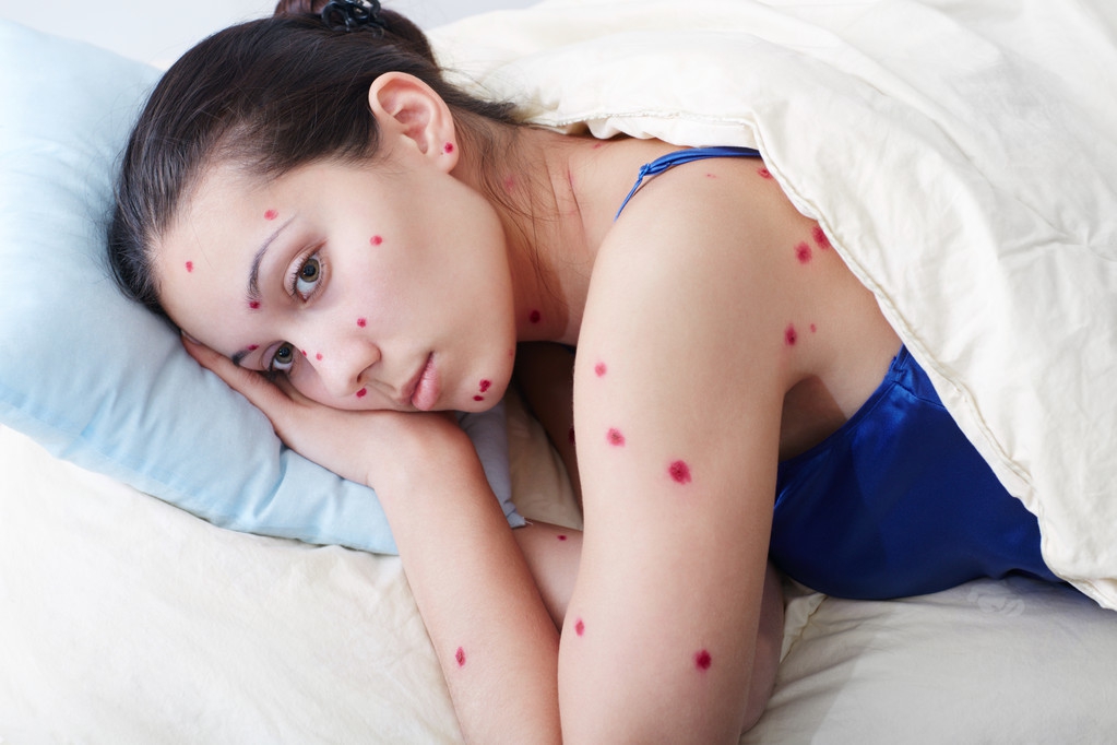 10几岁得淋巴癌能治好吗,8岁的孩子起水痘怎么办