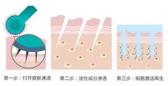 反孔大作战专治你的毛孔粗大