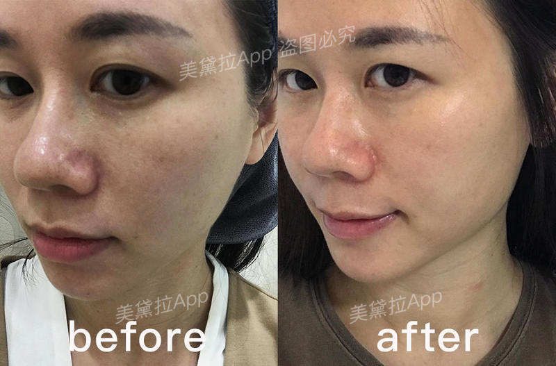 类人胶原蛋白能收缩毛孔么,胶原蛋白抗皱原液真实测评