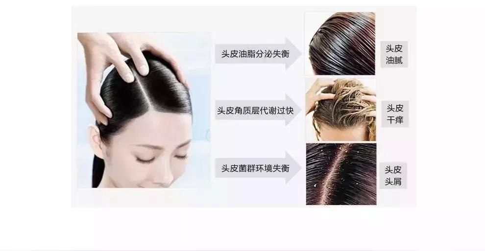 二甲硅油片对胃有伤害吗,硅油对眼睛有什么伤害