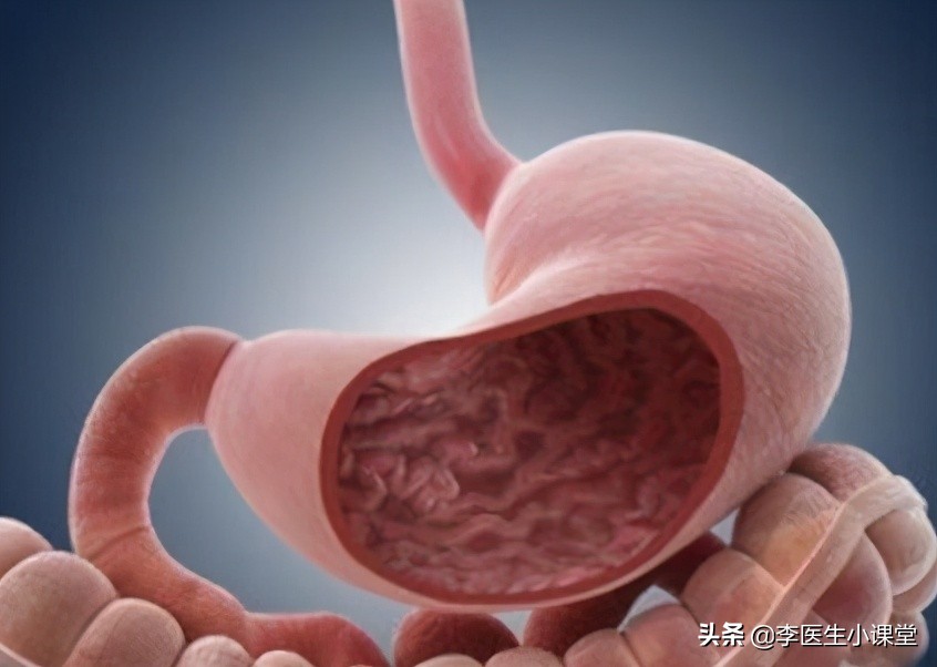 萎缩性胃炎到胃癌经历几步,慢性萎缩性胃炎复发变胃癌吗