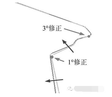 翼子板凹陷自动回弹怎么办,翼子板成型难点