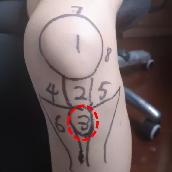 不同部位膝关节,骨科医生教你一招搞定膝盖痛