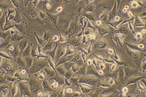 人们为什么害怕癌症病人,抗癌化疗药物有哪些副作用