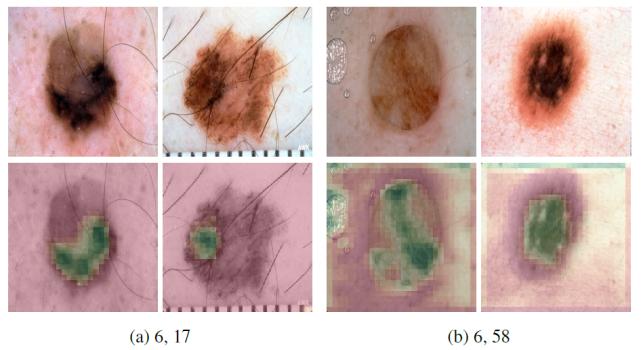 浅谈医学影像技术,医学图像分析深度学习模型