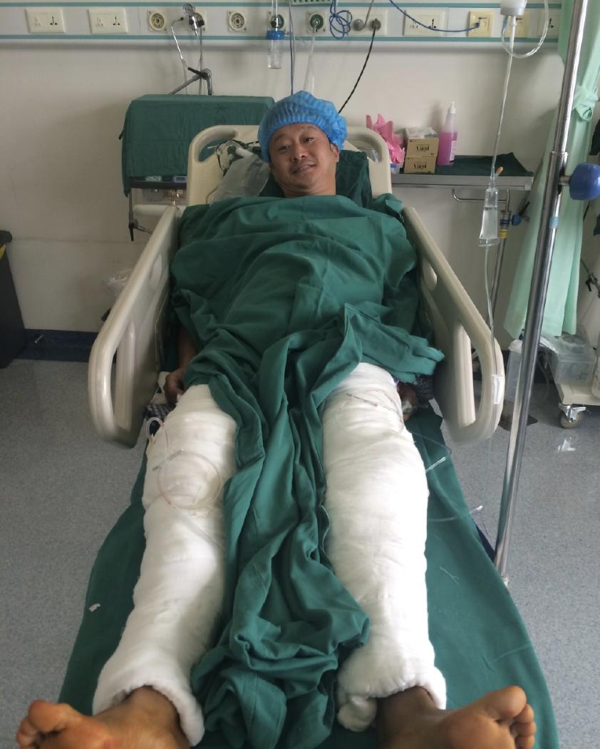 吴京受伤后的表现,吴京受伤记录