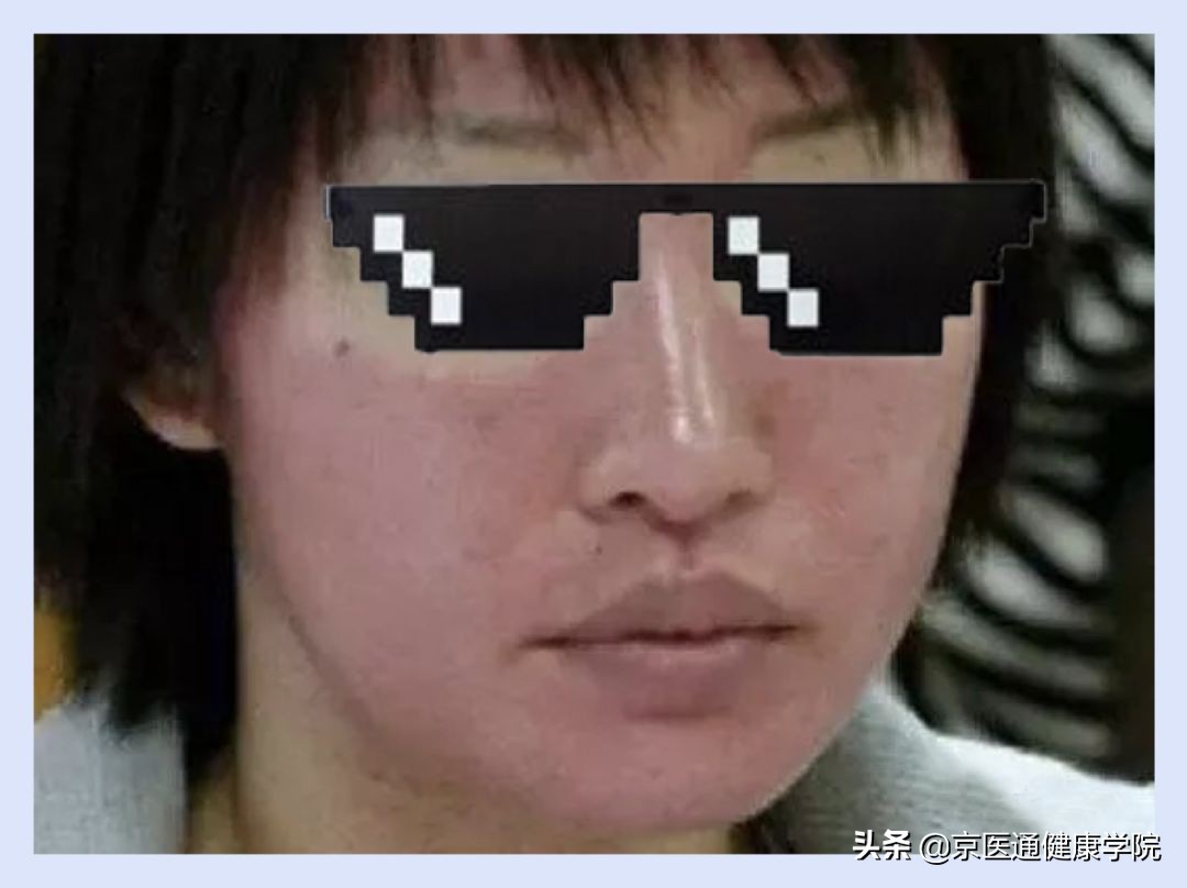 菲洛嘉一支能打全脸吗,菲洛嘉可以单独操作吗