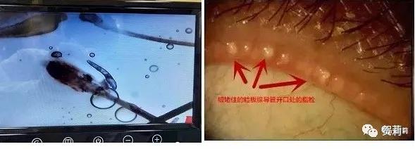 眼睛发干发涩发胀什么原因,眼睛发涩疲倦头发胀是怎么回事