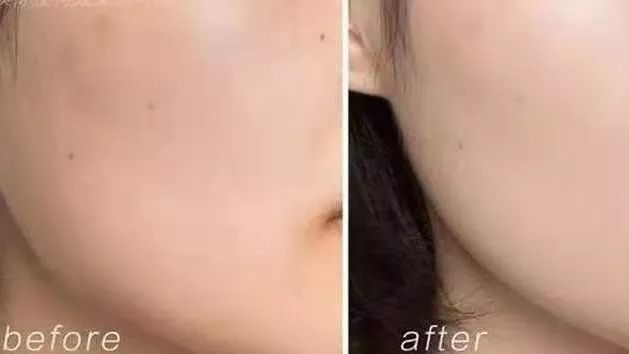 购买全球好物严选推荐,修护舒缓水种草