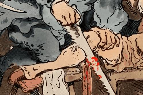 鍙や唬鍖诲鎵嬫湳,涓浗鍙や唬鍖诲鎵嬫湳