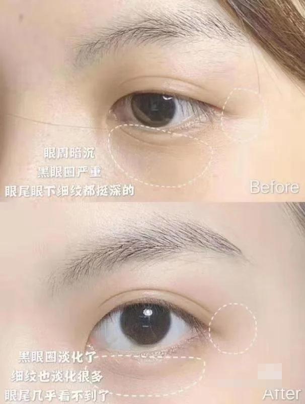 眼霜怎么涂才不白,眼霜不浪费操作步骤