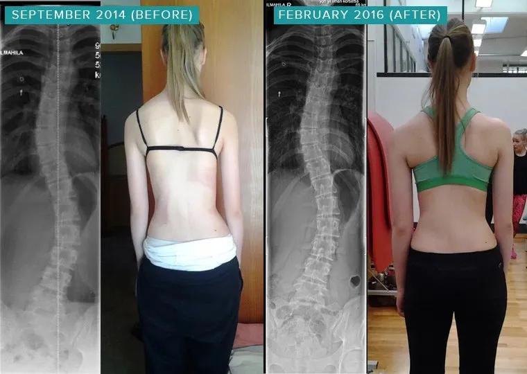 sps鍒涘浜虹悊鏌ュ痉,鐞嗘煡寰蜂翰鎺坰ps瀵煎笀