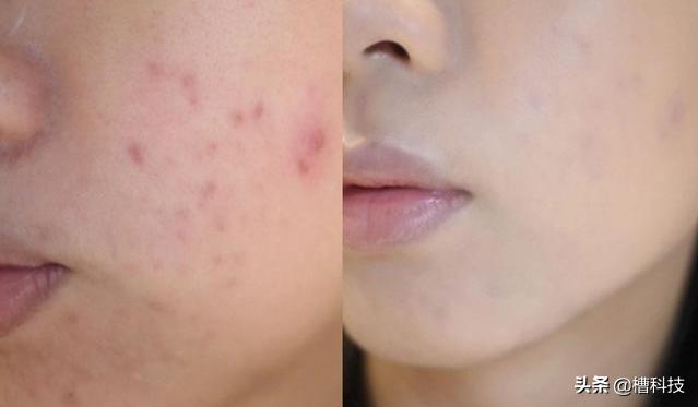 小米有品黑科技剃须刀,小米手机黑科技神器