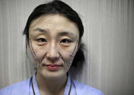 面部微整形的危害,为什么微整形面部变残