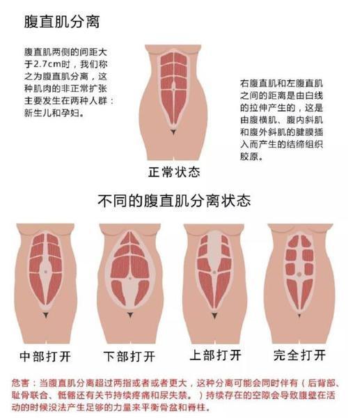 产后恢复包含哪些项目,产后恢复都包含哪些项目