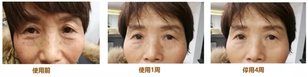 香港明星代言补水去黄提亮面膜,各路明星推荐的面膜怎么样