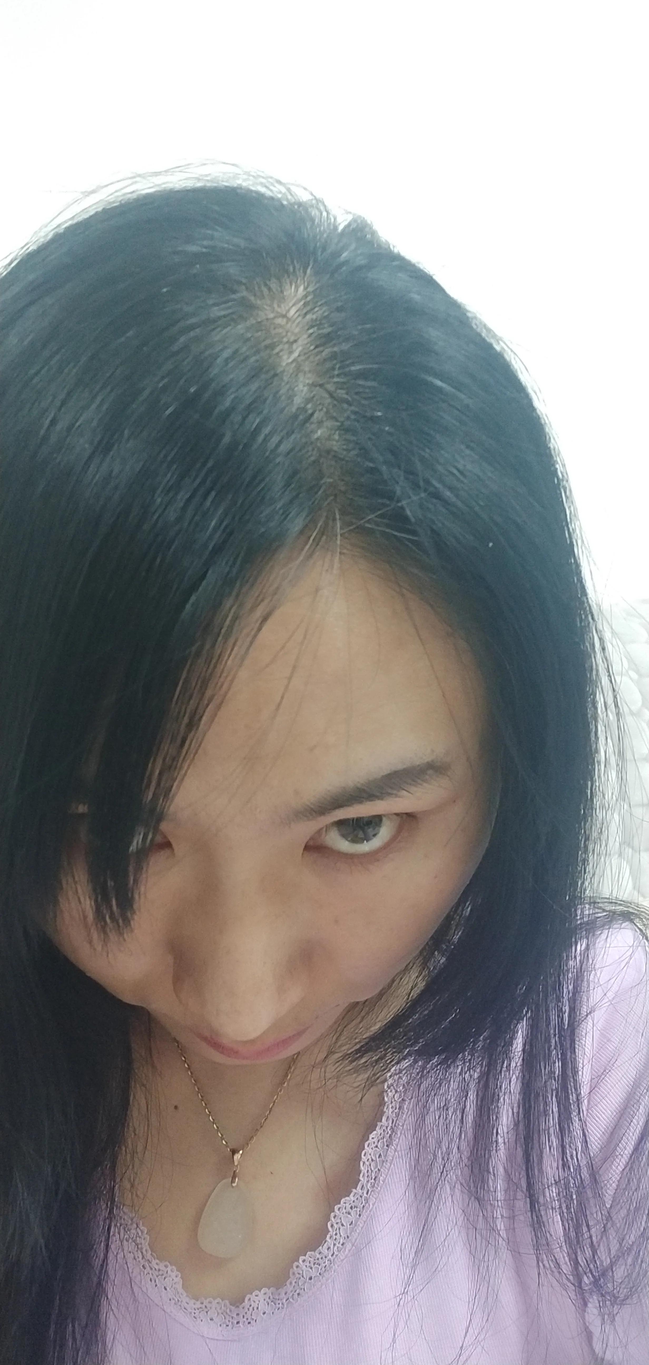 防脱发小妙招搞笑,防脱发生发的最好办法